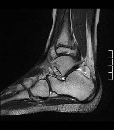 Figure 3 for case normal foot